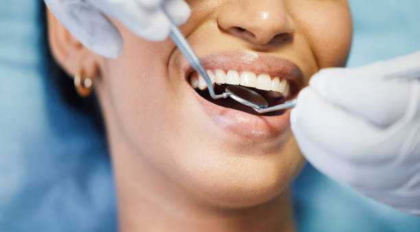 Best Broken or Cracked Tooth Emergency Dentist in Purdy, MO