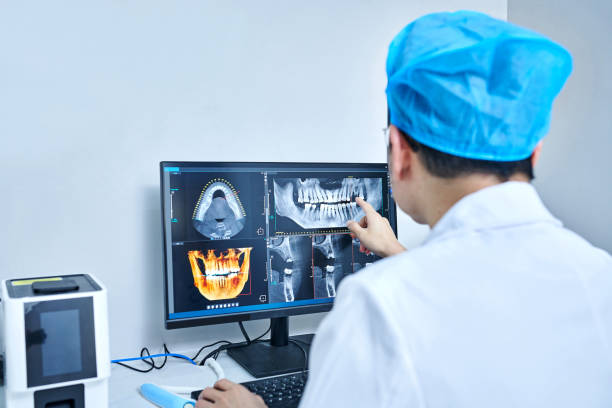 Best Emergency Root Canal Treatment in Purdy, MO